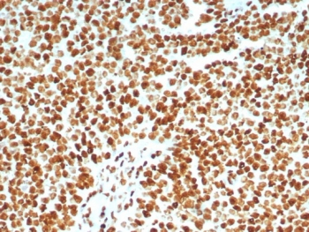 Ku80 Antibody