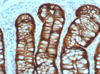 Villin Antibody / VIL1