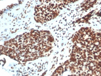 XRCC5 Antibody