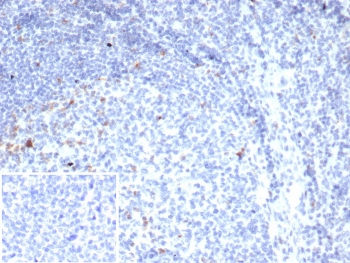 CTLA4 Antibody / CD152