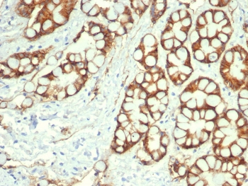 EpCAM Antibody