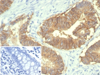 EpCAM Antibody