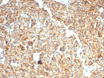 EpCAM Antibody