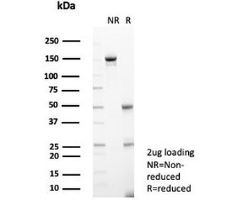 IL1RN Antibody / Interleukin-1 Receptor Antagonist / IL-1RA