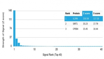 IL1RN Antibody / Interleukin-1 Receptor Antagonist / IL-1RA