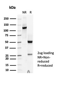 Thyroid Peroxidase Antibody / TPO