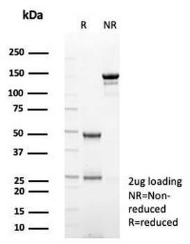 Recombinant TPO Antibody / Thyroid Peroxidase