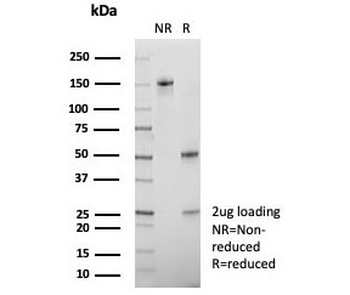 CEBPZ Antibody