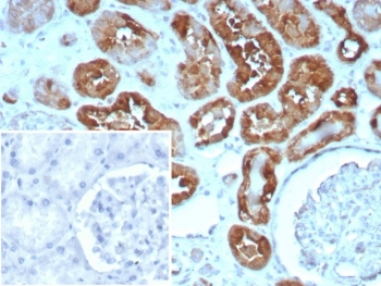 H-FABP Antibody / Heart Fatty Acid Binding Protein / FABP3