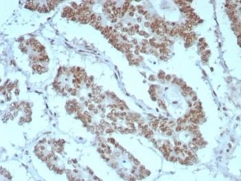 BAF47 Antibody / Integrase interactor 1 / SMARCB1