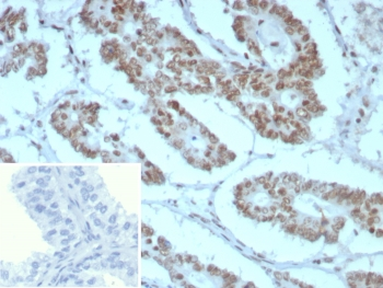 BAF47 Antibody / Integrase interactor 1 / SMARCB1