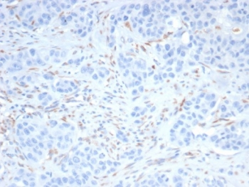 Sal-like 4 Antibody / SALL4