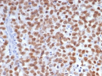 Sal-like 4 Antibody / SALL4