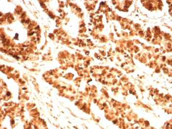 PCNA Antibody / Proliferating Cell Nuclear Antigen