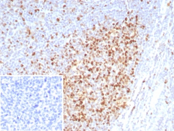 PCNA Antibody / Proliferating Cell Nuclear Antigen