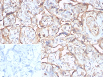 TGF beta 2 Antibody / TGFB2
