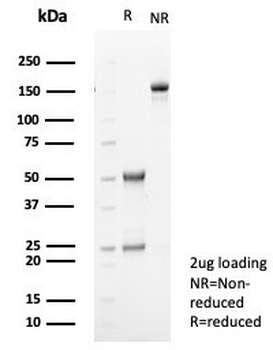 TGF beta 2 Antibody / TGFB2