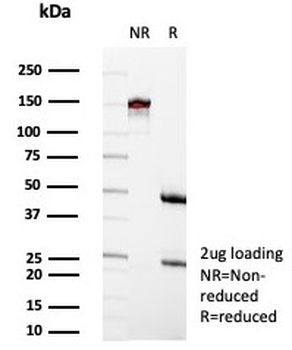 Recombinant CR1 Antibody / CD35