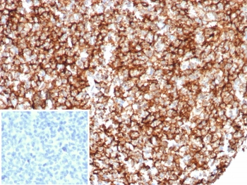 Recombinant CR1 Antibody / CD35