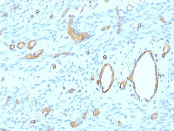 Recombinant CD34 Antibody
