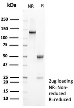 Interleukin 10 Antibody / IL-10