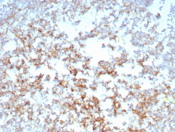 CD21 Antibody