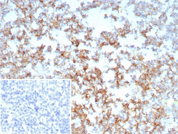 CD21 Antibody