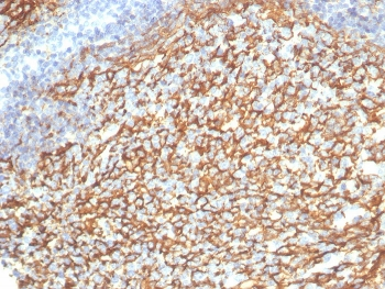 CD21 Antibody