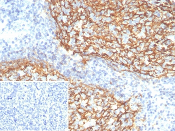 CD21 Antibody