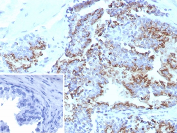 Prostein Antibody / SLC45A3