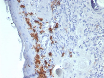 CD1a Antibody