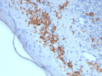 CD1a Antibody