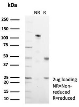 Mucin 1 Antibody / MUC1
