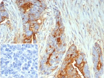 Mucin 1 Antibody / MUC1