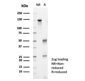 CGRP Antibody / S100A12