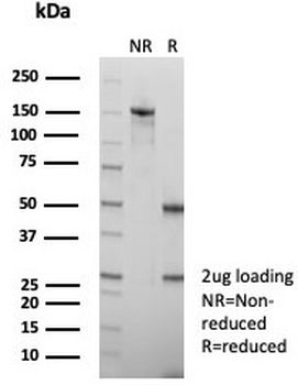 Recombinant ROR gamma Antibody / RORC