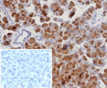 ROR gamma Antibody / RORC