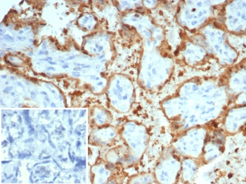 S100A12 Antibody / CGRP
