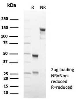 Recombinant PDPN Antibody / Podoplanin / Gp36