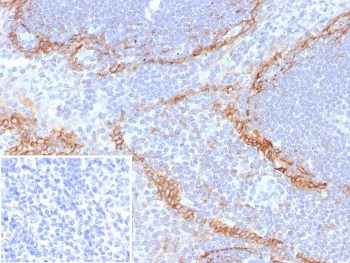 Recombinant PDPN Antibody / Podoplanin / Gp36
