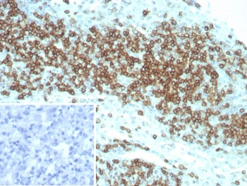 CD2 Antibody