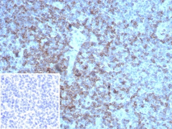 Recombinant LFA-2 Antibody / CD2