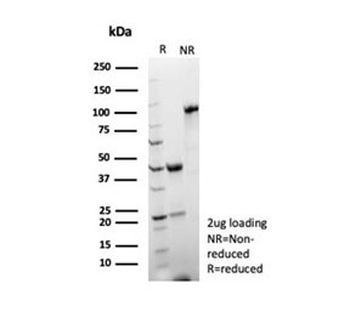 Recombinant LFA-2 Antibody / CD2