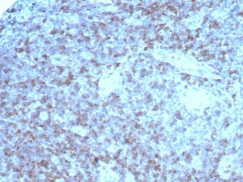 Recombinant LFA-2 Antibody / CD2