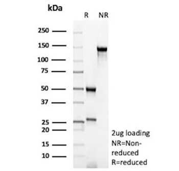 Recombinant Bax Antibody