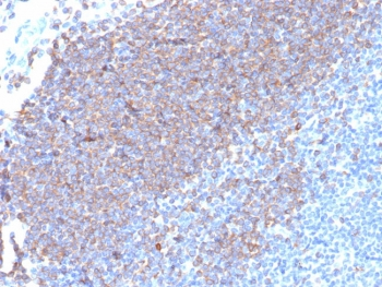 CD79a Antibody