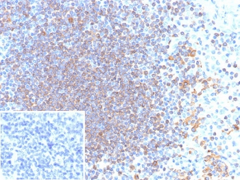 CD79a Antibody
