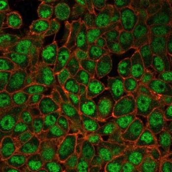 Upstream stimulatory factor 2 Antibody / USF2
