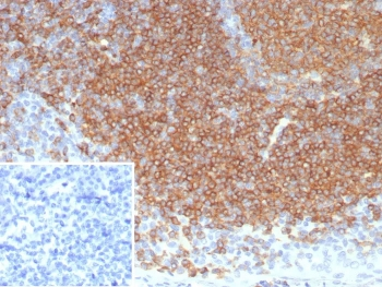 CD22 Antibody / BL-CAM