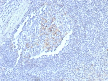 CD23 Antibody